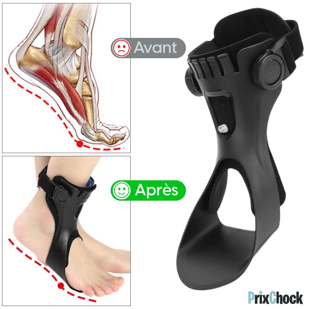 Releveur de Pied AFO – Maintien du Pied & de la Cheville