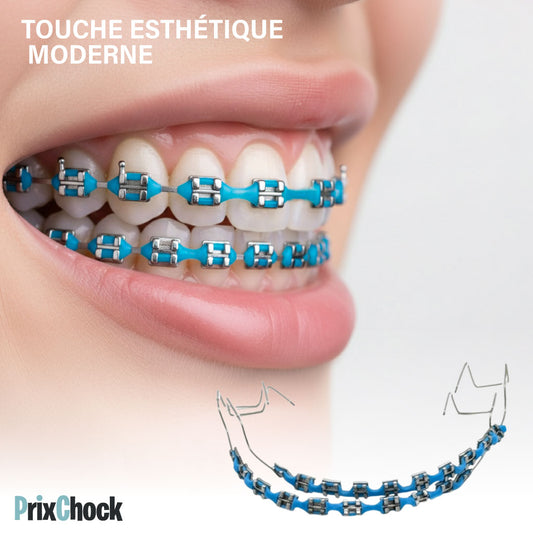Décoration Dentaire Temporaire – Style Orthodontique