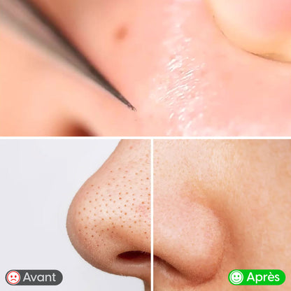 Kit de Soins du Visage – Set 3 Pièces