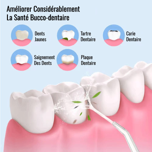 Nettoyeur Dentaire Portable – Hygiène & Confort