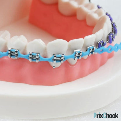 Décoration Dentaire Temporaire – Style Orthodontique