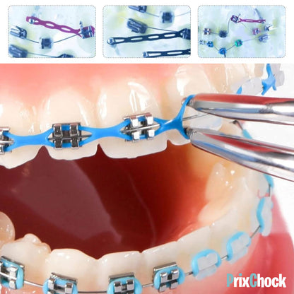 Décoration Dentaire Temporaire – Style Orthodontique